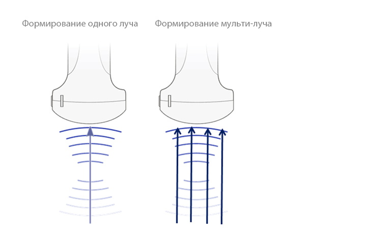 %D0%A4%D0%BE%D1%80%D0%BC%D0%B8%D1%80%D0%BE%D0%B2%D0%B0%D0%BD%D0%B8%D0%B5-%D0%BC%D1%83%D0%BB%D1%8C%D1%82%D0%B8-%D0%BB%D1%83%D1%87%D0%B0.jpg?1649741161717