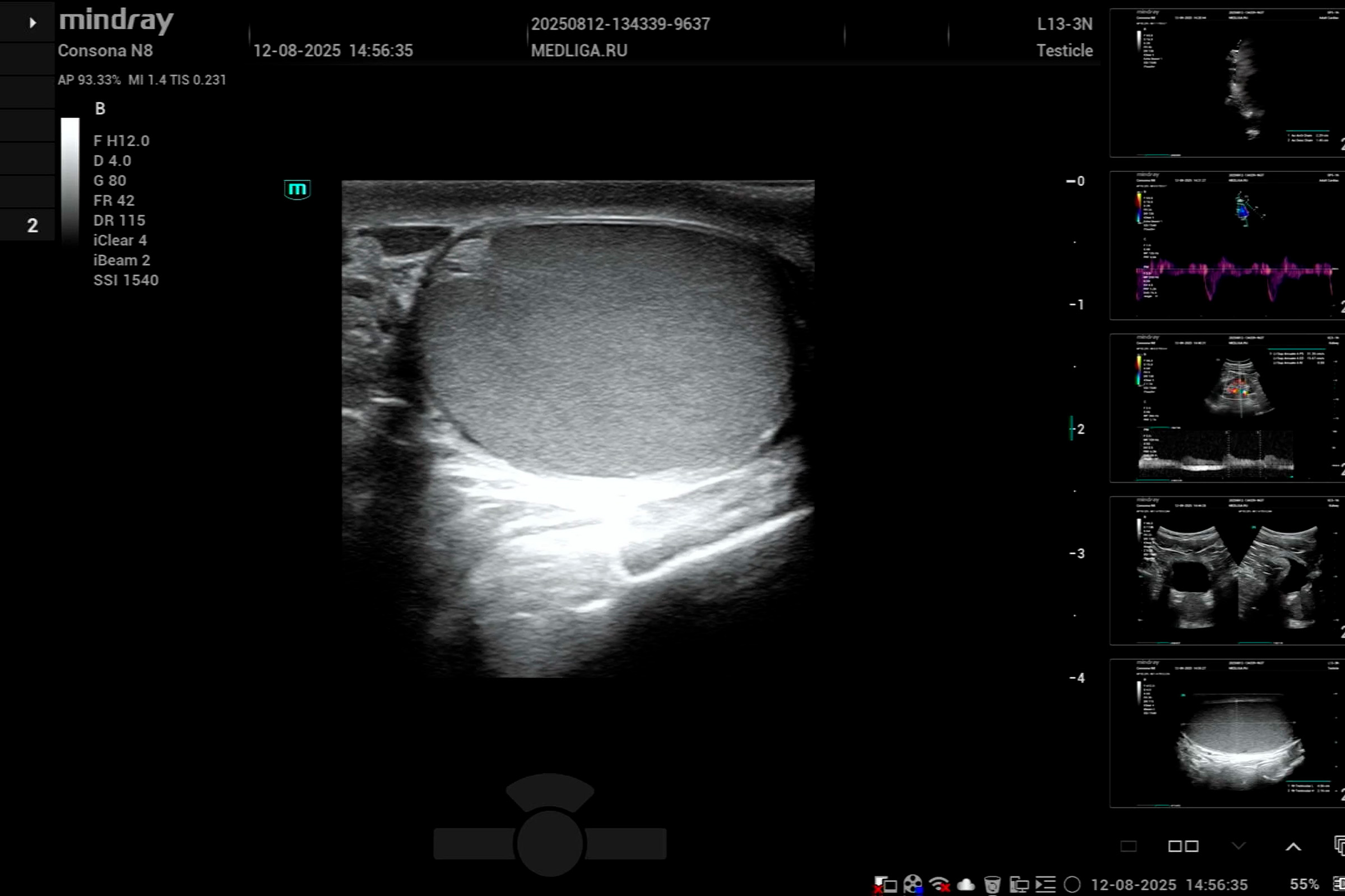 УЗИ мошонки: мастер-класс на Mindray Consona N8